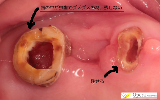 2013.11.26-01